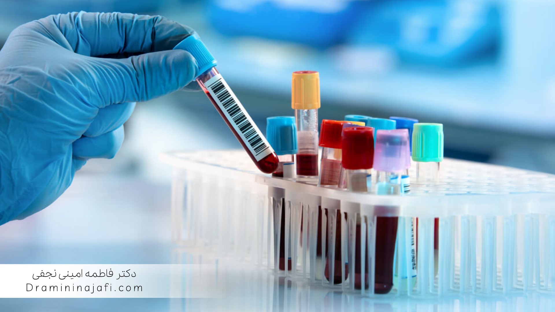 اعتبارسنجی روشهای آزمون و آنالیز ویتامین با اچپیالسی