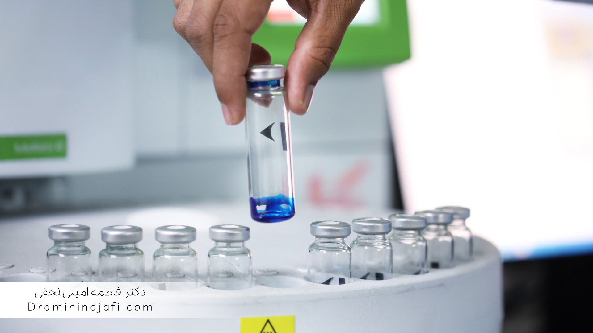 پیاده‌سازی LIMS در آزمایشگاه‌های متوسط با کشت میکروبی و شمارش کلونی